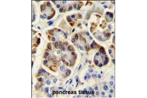 KCNJ6 Antibody (Center) (ABIN652033 and ABIN2840507) immunohistochemistry analysis in formalin fixed and paraffin embedded human pancreas tissue followed by peroxidase conjugation of the secondary antibody and DAB staining. (KCNJ6 anticorps  (AA 26-55))