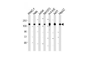 All lanes : Anti-SF3B1 Antibody (N-term) at 1:2000 dilution Lane 1: NC-1 whole cell lysate Lane 2: Hela whole cell lysate Lane 3: Jurkat whole cell lysate Lane 4: NIH/3T3 whole cell lysate Lane 5: H-4-II-E whole cell lysate Lane 6: A431 whole cell lysate Lane 7: HepG2 whole cell lysate Lysates/proteins at 20 μg per lane. (SF3B1 anticorps  (N-Term))