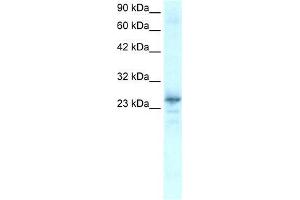 Human Heart; WB Suggested Anti-NKX2-8 Antibody Titration: 0. (NKX2-8 anticorps  (C-Term))
