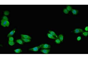 Immunofluorescent analysis of HepG2 cells using ABIN7170866 at dilution of 1:100 and Alexa Fluor 488-congugated AffiniPure Goat Anti-Rabbit IgG(H+L) (SMC4 anticorps  (AA 406-501))