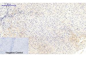 Immunohistochemical analysis of paraffin-embedded human liver tissue. (MEK1/2 anticorps  (pSer218, pSer222))
