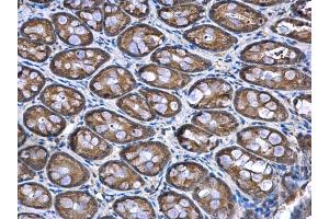 IHC-P Image NDUFA12 antibody [N1C3] detects NDUFA12 protein at mitochondria in rat colon by immunohistochemical analysis. (NDUFA12 anticorps  (full length))