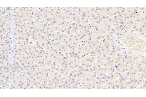 Detection of PDPK1 in Human Liver Tissue using Polyclonal Antibody to Phosphoinositide Dependent Protein Kinase 1 (PDPK1)