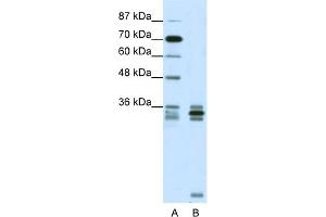 WB Suggested Anti-OLIG2 Antibody Titration: 0. (OLIG2 anticorps  (C-Term))