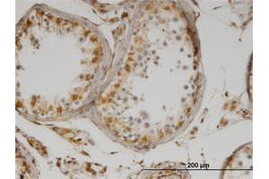 Immunoperoxidase of monoclonal antibody to IL13 on formalin-fixed paraffin-embedded human testis.