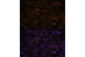 Immunofluorescence analysis of C6 cells using GRSF1 antibody (ABIN7267319) at dilution of 1:100. (GRSF1 anticorps)