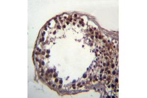 Formalin fixed, paraffin embedded human testis tissue stained with DAZ3 (C-term) followed by peroxidase conjugation of the secondary antibody and DAB staining. (DAZ3 anticorps  (C-Term))