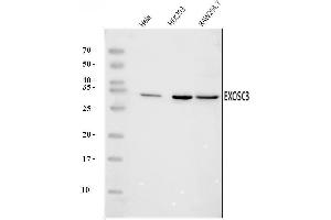 Western blot analysis of EXOSC3 using anti-EXOSC3 antibody (ABIN7602216).