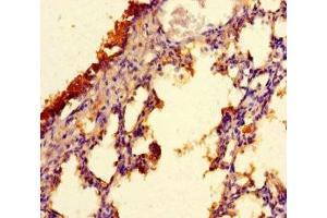 Immunohistochemistry of paraffin-embedded human lung tissue using ABIN7147754 at dilution of 1:100 (C9orf117 anticorps  (AA 1-200))