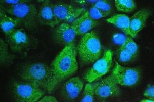 IF analysis of Galectin 3/LGALS3 using anti-Galectin 3/LGALS3 antibody (ABIN6719486).