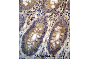 ASMTL Antibody (Center) (ABIN657160 and ABIN2846294) immunohistochemistry analysis in formalin fixed and paraffin embedded human colon tissue followed by peroxidase conjugation of the secondary antibody and DAB staining. (ASMTL anticorps  (AA 231-259))
