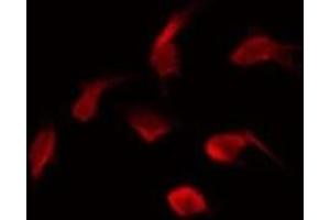 ABIN6275530 staining HepG2 by IF/ICC. (NEK5 anticorps  (Internal Region))