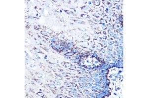 Immunohistochemistry of paraffin-embedded human esophageal using MMP3 Rabbit mAb (ABIN7268424) at dilution of 1:100 (40x lens). (MMP3 anticorps)