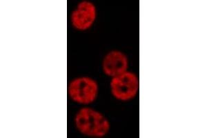 ABIN6276566 staining  Hela cells by IF/ICC. (NEDD8 anticorps  (Internal Region))