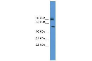 Western Blot showing OSBPL11 antibody used at a concentration of 1-2 ug/ml to detect its target protein. (OSBPL11 anticorps  (C-Term))