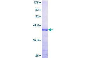 Image no. 1 for Tax1 (Human T-Cell Leukemia Virus Type I) Binding Protein 3 (TAX1BP3) (AA 1-124) protein (GST tag) (ABIN1322198)