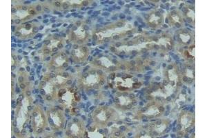 Detection of FASL in Rat Kidney Tissue using Polyclonal Antibody to Factor Related Apoptosis Ligand (FASL)