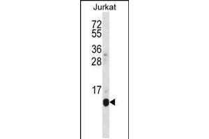 Western blot analysis in Jurkat cell line lysates (35ug/lane). (POLR2G anticorps  (C-Term))
