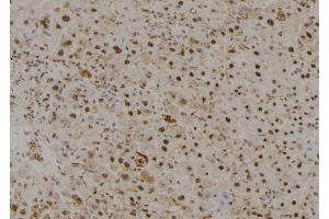 ABIN6278938 at 1/100 staining Mouse liver tissue by IHC-P. (MYST3 anticorps  (N-Term))
