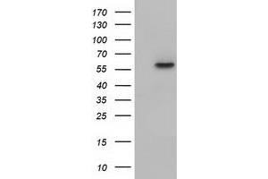 Western Blotting (WB) image for anti-Kelch-Like 2, Mayven (KLHL2) (AA 1-100), (AA 494-593) antibody (ABIN1490546) (KLHL2 anticorps  (AA 1-100, AA 494-593))