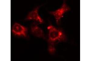 ABIN6275626 staining HepG2 cells by IF/ICC. (CCT6A anticorps  (Internal Region))