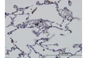Immunoperoxidase of monoclonal antibody to GIT2 on formalin-fixed paraffin-embedded human lung.