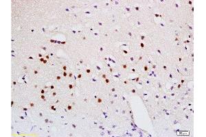 Formalin-fixed and paraffin embedded mouse brain labeled with Anti-Sema3A Polyclonal Antibody, Unconjugated  at 1:200 followed by conjugation to the secondary antibody and DAB staining. (SEMA3A anticorps  (AA 22-120))