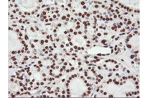 Image no. 1 for anti-F-Box Protein 21 (FBXO21) antibody (ABIN1498233) (FBXO21 anticorps)