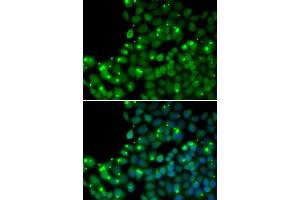 Immunofluorescence analysis of U2OS cells using MGMT antibody (ABIN5970267). (MGMT anticorps)