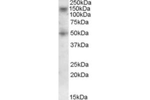 Western Blotting (WB) image for anti-Ring Finger Protein 139 (RNF139) (C-Term) antibody (ABIN2466775) (RNF139 anticorps  (C-Term))
