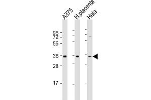All lanes : Anti-FGF5 Antibody (N-Term) at 1:2000 dilution Lane 1:  whole cell lysate Lane 2: human placenta lysate Lane 3: Hela whole cell lysate Lysates/proteins at 20 μg per lane. (FGF5 anticorps  (AA 140-172))