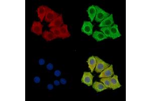 ABIN7096233 and ABIN7100295 staining Hela cells by IF/ICC. (PCMTD1 anticorps)