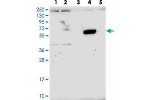 Western blot analysis of Lane 1: RT-4, Lane 2: U-251 MG, Lane 3: Human Plasma, Lane 4: Liver, Lane 5: Tonsil with ZNF837 polyclonal antibody  at 1:250-1:500 dilution. (ZNF837 anticorps)