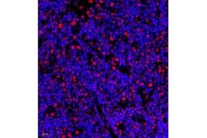 Immunofluorescence of paraffin embedded rat thymus using Skar (ABIN7074970) at dilution of 1:950 (400x lens) (p46 anticorps)