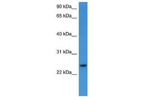 Western Blot showing RHOG antibody used at a concentration of 1-2 ug/ml to detect its target protein.