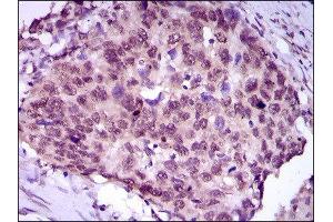 Immunohistochemistry (IHC) image for anti-Myocyte Enhancer Factor 2C (MEF2C) (AA 1-125) antibody (ABIN1846463) (MEF2C anticorps  (AA 1-125))
