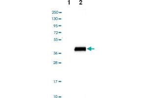 Western blot analysis of Lane 1: Negative control (vector only transfected HEK293T lysate), Lane 2: Over-expression lysate (Co-expressed with a C-terminal myc-DDK tag (~3. (SULT4A1 anticorps)