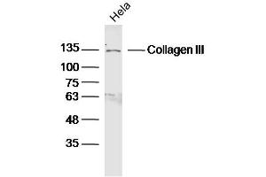 Hela lysates probed with Collagen III Polyclonal Antibody, Unconjugated  at 1:300 dilution and 4˚C overnight incubation.