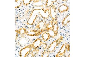 Immunohistochemistry of paraffin embedded human kidney using SLC22A12 (ABIN7075662) at dilution of 1:2100 (300x lens) (SLC22A12 anticorps)