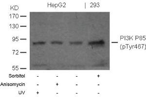 Image no. 1 for anti-Phosphoinositide 3 Kinase, p85 alpha (PI3K p85a) (pTyr467) antibody (ABIN372743) (PIK3R1 anticorps  (pTyr467))