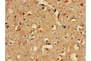 Immunohistochemistry of paraffin-embedded human brain tissue using ABIN7170645 at dilution of 1:100