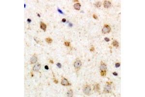 Immunohistochemical analysis of GPR126 staining in human brain formalin fixed paraffin embedded tissue section. (G Protein-Coupled Receptor 126 anticorps)