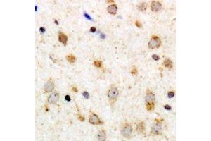 Immunohistochemical analysis of GPR126 staining in human brain formalin fixed paraffin embedded tissue section.