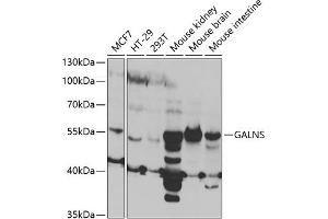 Western blot analysis of extracts of various cell lines, using GALNS antibody (ABIN6131691, ABIN6140937, ABIN6140938 and ABIN6221120) at 1:1000 dilution.
