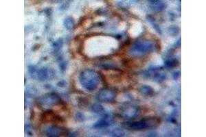 #VALUE! (CD166 anticorps  (AA 28-527))