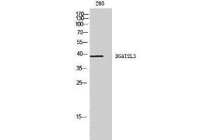 Western Blotting (WB) image for anti-Acyl-CoA Wax Alcohol Acyltransferase 1 (AWAT1) (C-Term) antibody (ABIN3184289) (AWAT1 anticorps  (C-Term))