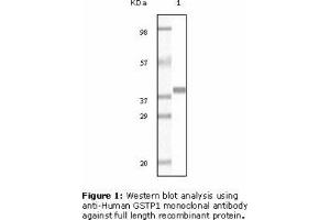 Image no. 2 for anti-Glutathione S-Transferase pi 1 (GSTP1) antibody (ABIN207627) (GSTP1 anticorps)