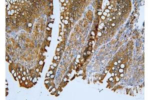 IHC analysis of ApoER2/LRP8 using anti-ApoER2/LRP8 antibody (ABIN7601752).