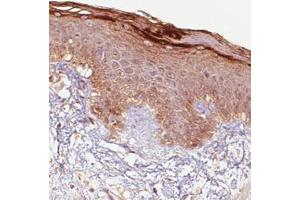 Immunohistochemical staining (Formalin-fixed paraffin-embedded sections) of human skin with RNASE7 monoclonal antibody, clone CL0224  shows immunoreactivity in keratinocytes, particularly strong in the outer layer.