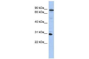 ANKRD47 antibody used at 1 ug/ml to detect target protein. (KANK3 anticorps  (N-Term))